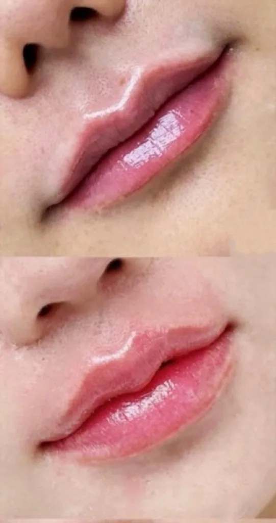 ยกริมฝีปาก