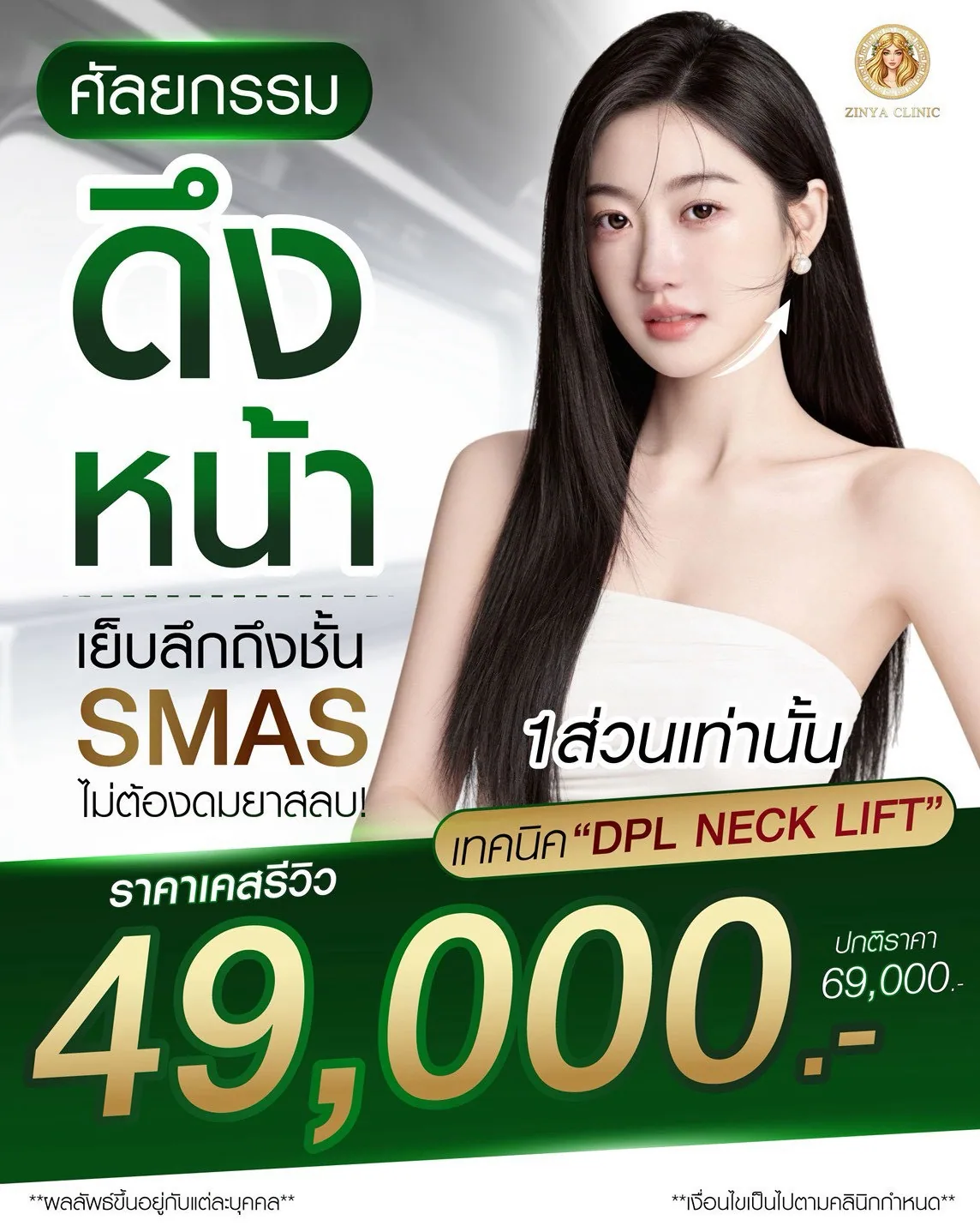ดึงหน้า SMAS ราคาเคสรีวิว 49,000
