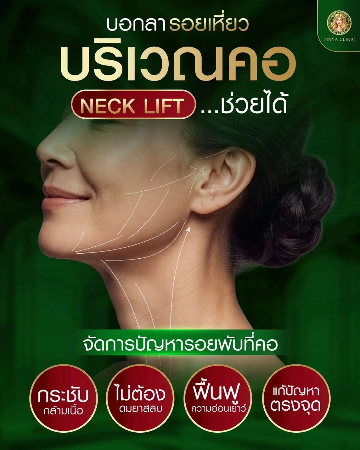 ดึงคอ