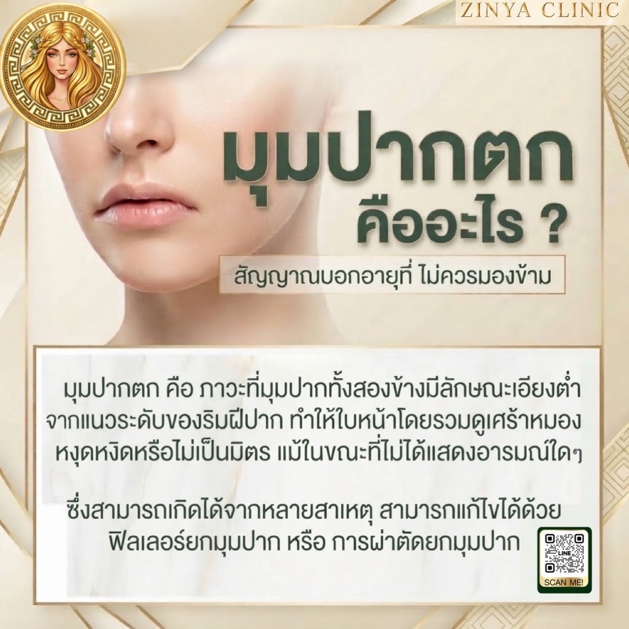 ภาพผลลัพธ์ศัลยกรรมริมฝีปาก
